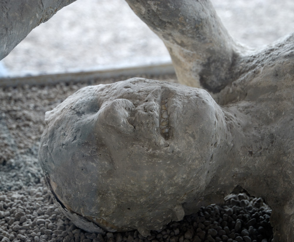 Pompei, Abguss eines der Opfer des Vulkanausbruches 79 n.Chr., Detail.